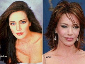 Hunter Tylo before and after plastic surgery 02