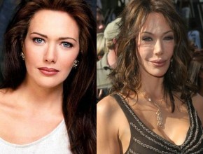 Hunter Tylo before and after plastic surgery 03