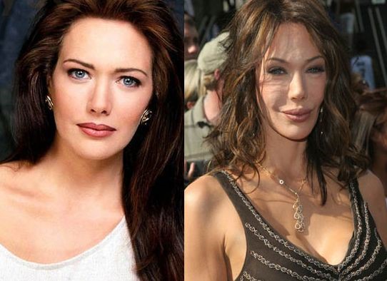 Hunter Tylo before and after plastic surgery 03