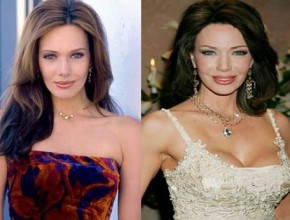 Hunter Tylo before and after plastic surgery 05