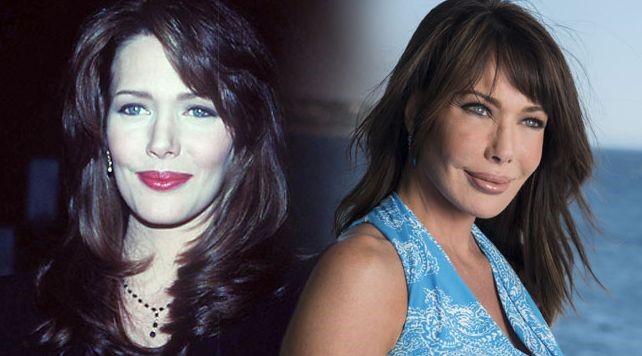 Hunter Tylo before and after plastic surgery