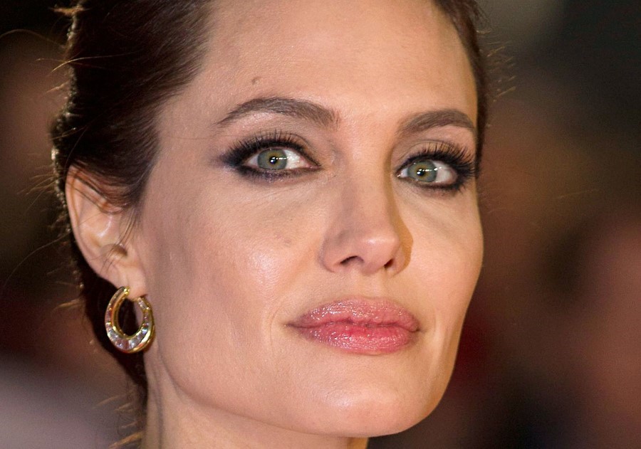 Angelina Jolie Plastic surgery 07 Celebrity plastic