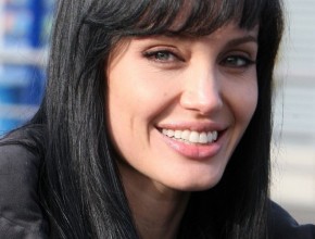 Angelina Jolie Plastic surgery 15