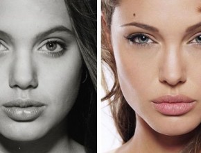 Angelina Jolie before and after plastic surgery 02