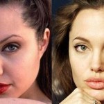 Angelina Jolie before and after plastic surgery 03