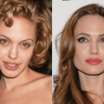 Angelina Jolie before and after plastic surgery 04