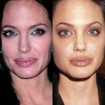 Angelina Jolie before and after plastic surgery 08