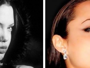 Angelina Jolie before and after plastic surgery 09