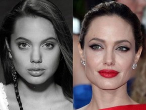 Angelina Jolie before and after plastic surgery 10