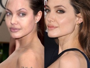 Angelina Jolie before and after plastic surgery and removing tatoo