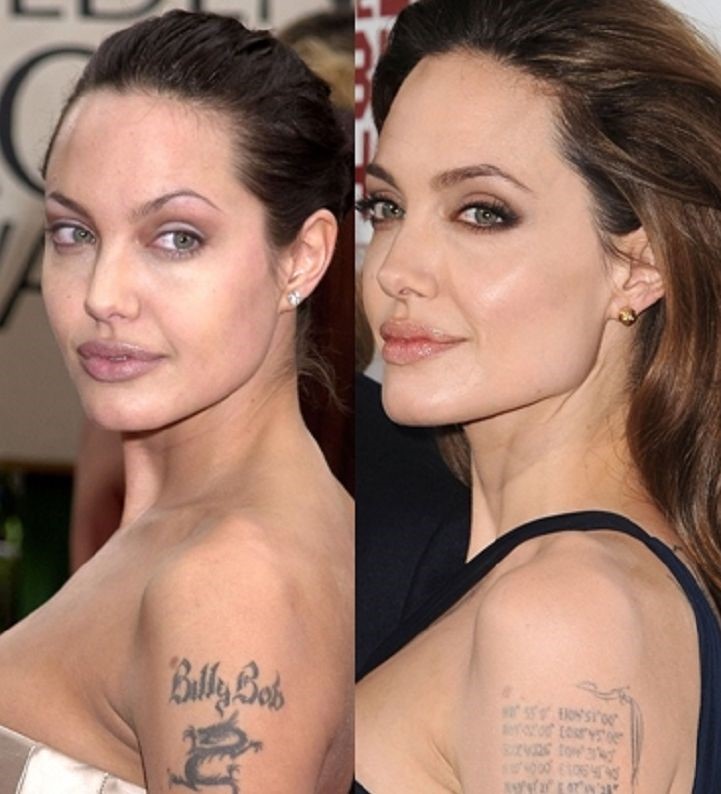 Angelina Jolie plastic surgery tweaks to improve her beauty!