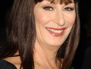 Anjelica Huston after plastic surgery 04