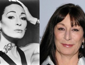 Anjelica Huston before and after plastic surgery