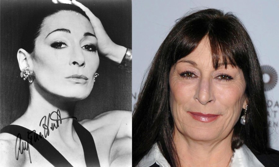 Anjelica Huston before and after plastic surgery
