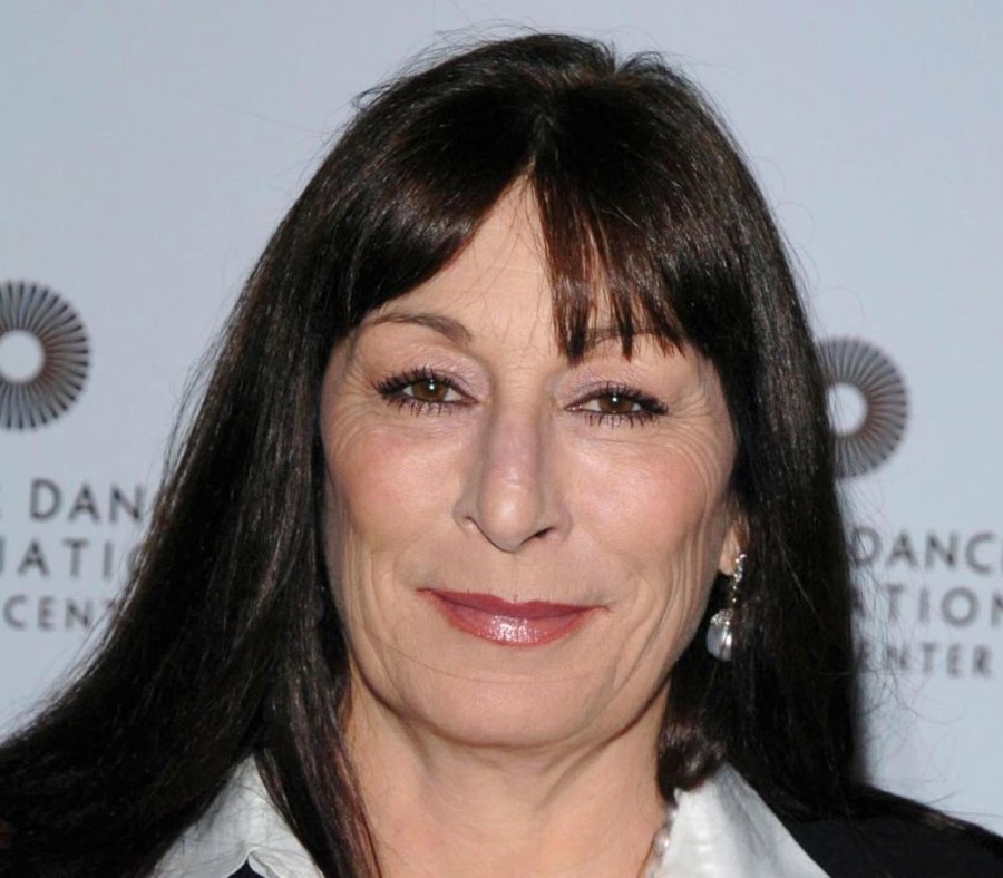 Anjelica Huston plastic surgery 02.