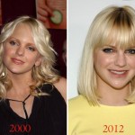 Anna Faris before and after plastic surgery 01