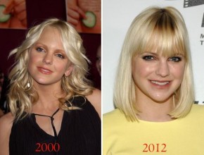 Anna Faris before and after plastic surgery 01