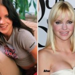 Anna Faris before and after plastic surgery 03