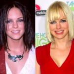 Anna Faris before and after plastic surgery 04
