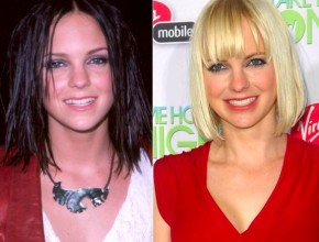 Anna Faris before and after plastic surgery 04