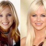 Anna Faris before and after plastic surgery 05