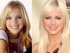 Anna Faris before and after plastic surgery 05