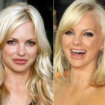 Anna Faris before and after plastic surgery 08