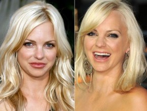 Anna Faris before and after plastic surgery 08