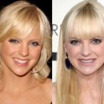 Anna Faris before and after plastic surgery 09