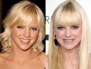 Anna Faris before and after plastic surgery 09
