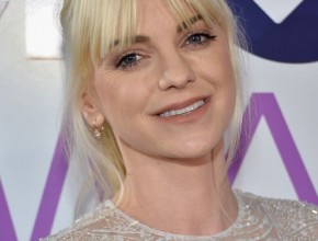 Anna Faris plastic surgery 06