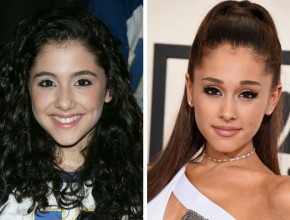 Ariana Grande before and after plastic surgery