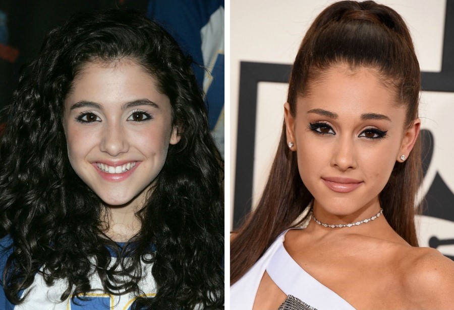 Ariana Grande before and after plastic surgery
