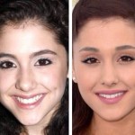 Ariana Grande before and after plastic surgery 02