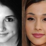 Ariana Grande before and after plastic surgery 03