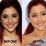 Ariana Grande before and after plastic surgery 04