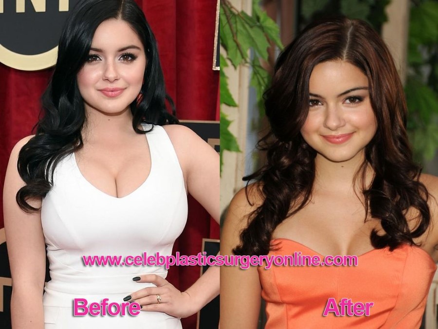 Ariel Winter before and after breasts reduction