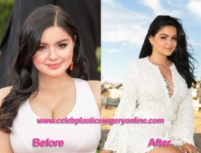 Ariel Winter before and after breasts reduction