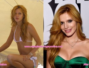 Bella Thorne before and after breasts augmentation