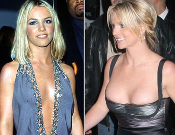 Britney Spears before and after breasts augmentation