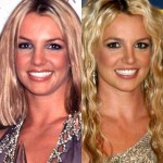 Britney Spears before and after plastic surgery 01