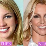 Britney Spears before and after plastic surgery 02