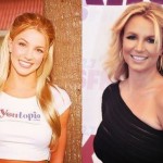 Britney Spears before and after plastic surgery 03