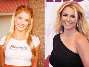 Britney Spears before and after plastic surgery 03