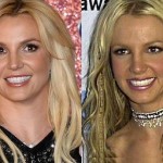 Britney Spears before and after plastic surgery 04
