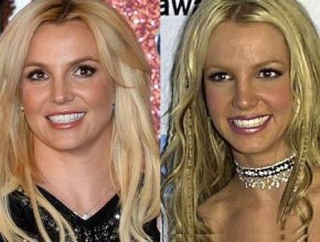 Britney Spears before and after plastic surgery 04