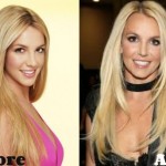 Britney Spears before and after plastic surgery 06