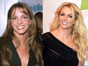 Britney Spears before and after plastic surgery 08