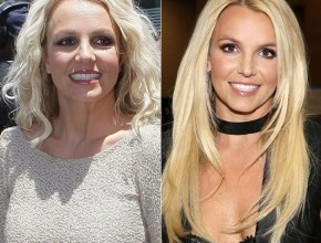 Britney Spears before and after plastic surgery 09
