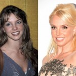 Britney Spears before and after plastic surgery 10